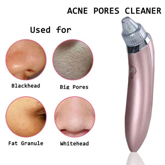 Face Vacuum Blackhead Remover Pore Cleaner